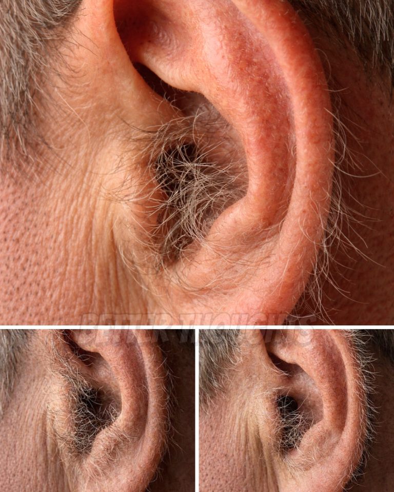 What Your Ear Hair Says About Your Health