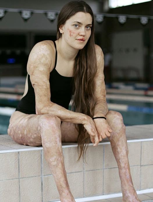 HT16. These are the consequences of sleeping co… See more