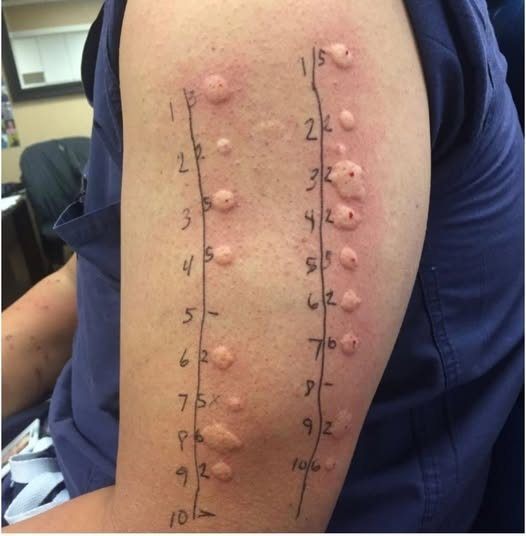 HT16. These are the consequences of sleeping with the… See more