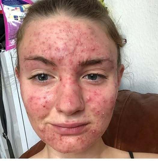 Her body was itching, thought it was an allergy but they diagnosed ca…