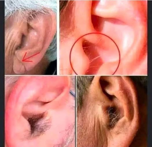 RF. Did you know that if your ear hairs grow, it is because your body is