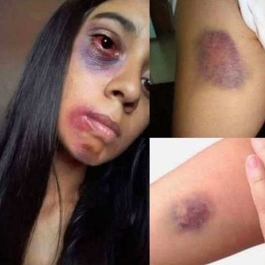 Young woman dies at the hands of her…See more