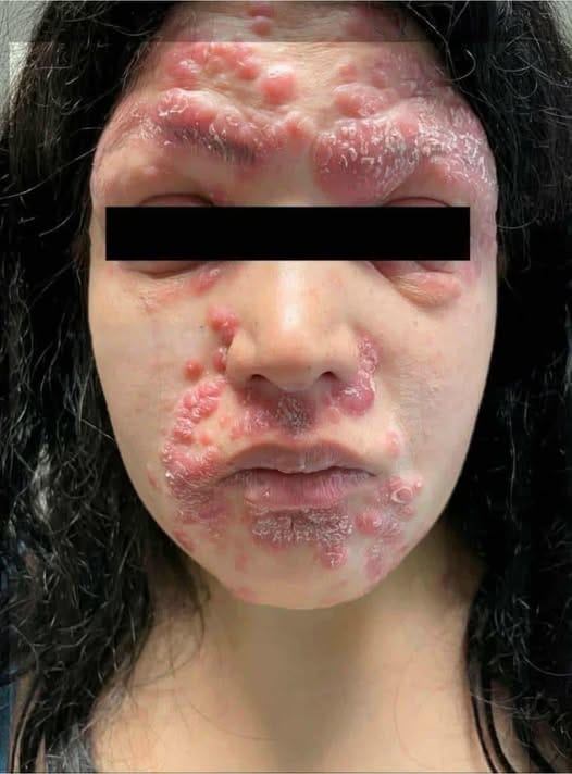 HT13. These are the consequences of sleeping co… See more