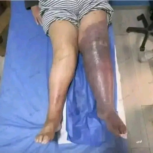 HT16. These are the consequences of sleeping with a… See more