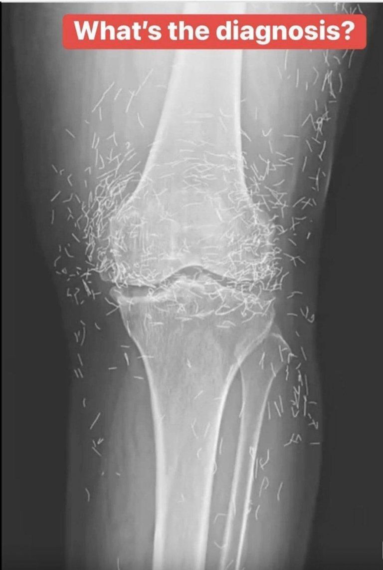 These are the consequences of sleeping with your c… See more