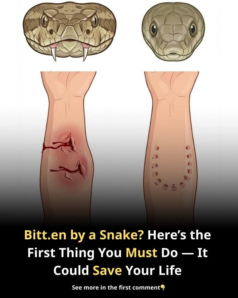 Bitten by a Snake? Here’s the First Thing You Must Do — It Could Save Your Life