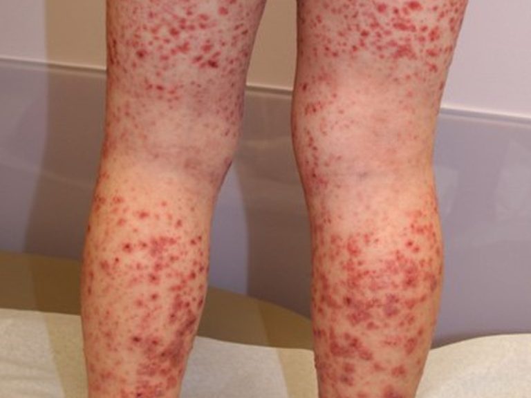 HT16. These are the consequences of sleeping with…See more